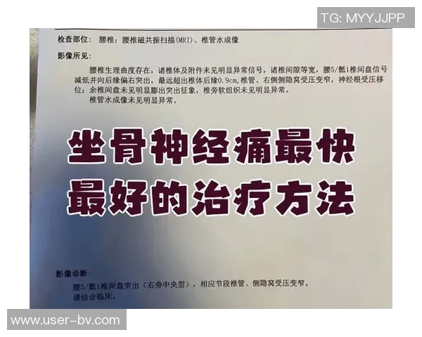 专家解读坐骨神经痛成因及治疗方法大多数患者可避免手术治疗